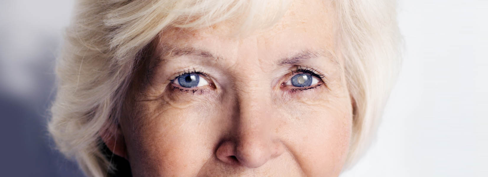 Cataract Surgery in University Place