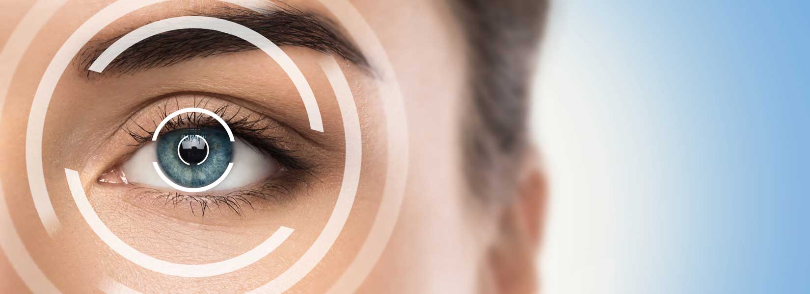 LASIK & Refractive Surgery Co-Management in University Place